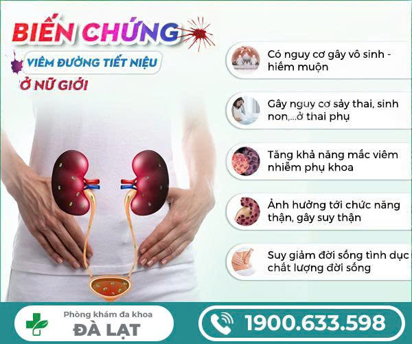 Hình ảnh minh họa